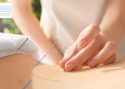 MJL Acupuncture : 21 rdv dès le premier mois de publicité sur Google